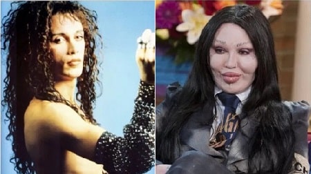 A picture of Pete Burns before (left) and after (right)  plastic surgery.